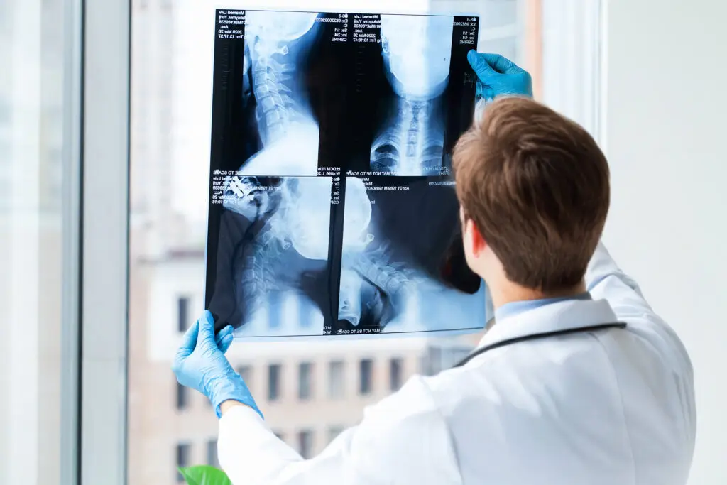 Doctor examines spinal X-rays near window.